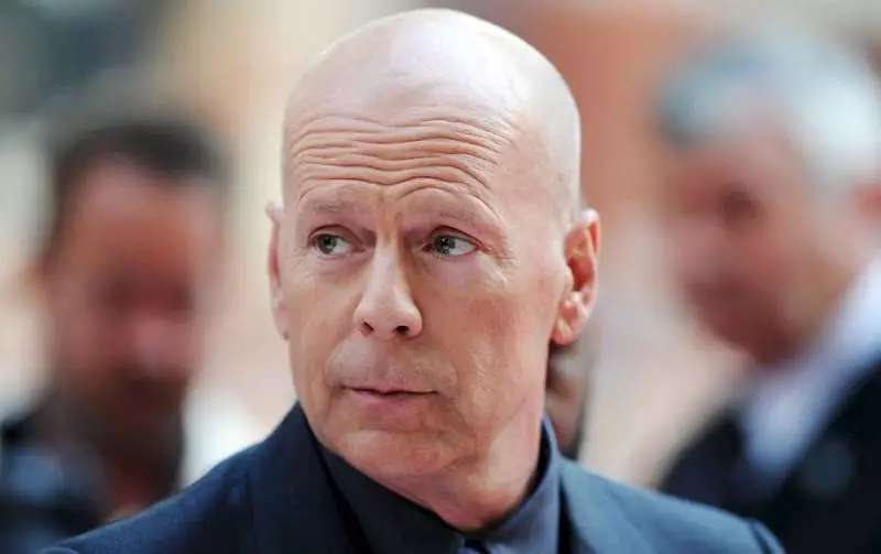 “Only Bruce Willis Has Rights to Bruce Willis’ Face,” the Actor Claims in A Statement!